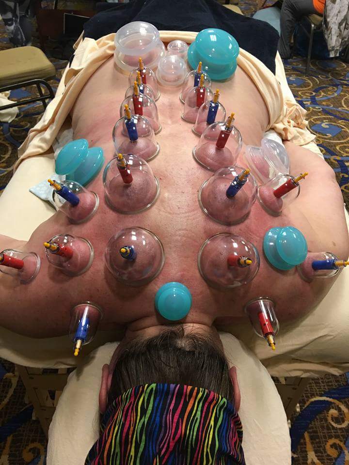 A Cupping Blanket. Balances energy, relaxes back muscles.